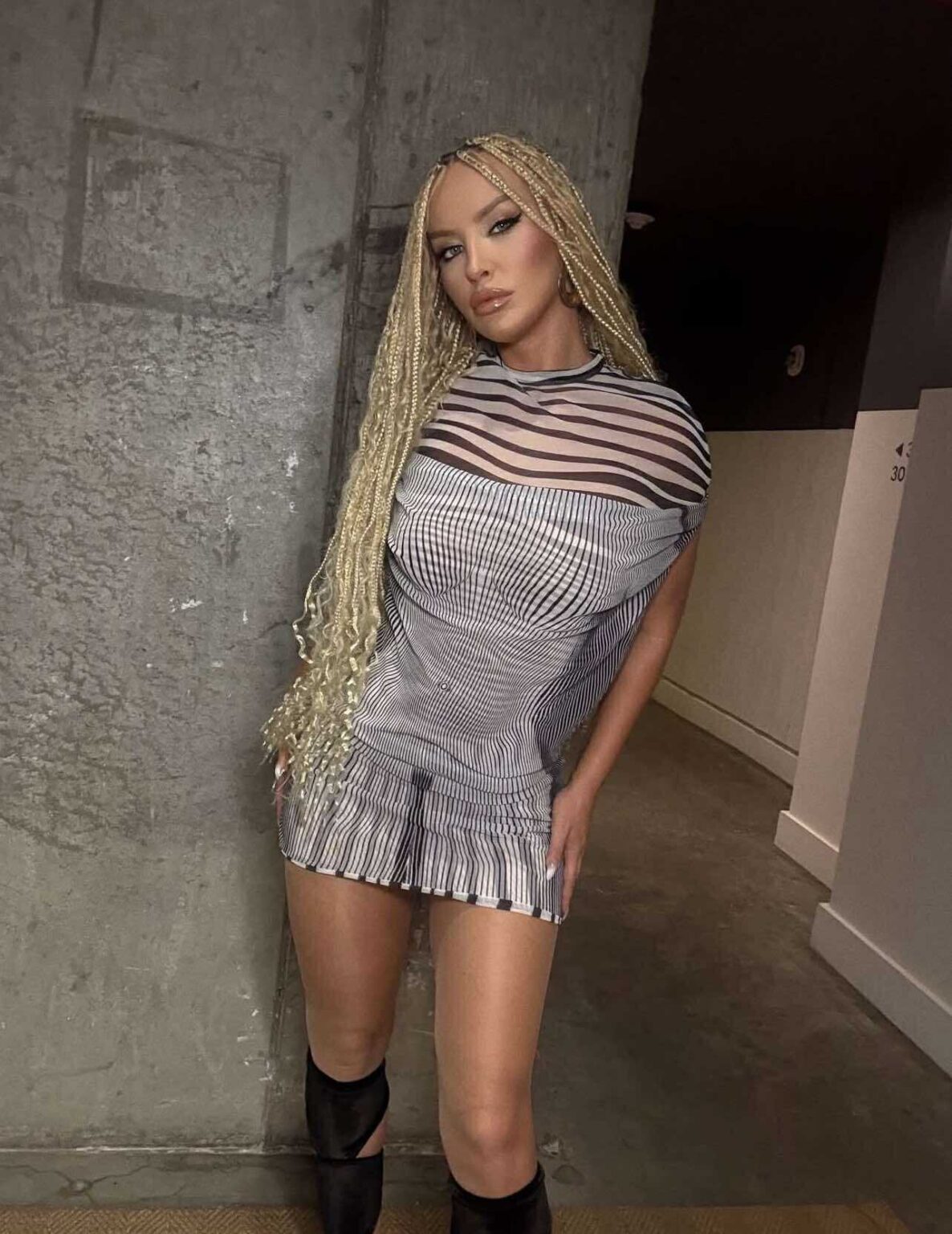 Çfarë ndërhyrjesh bëri në trup Tuna për t’u dukur në formë?